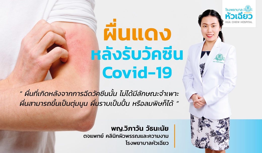 ผื่นแดงหลังรับวัคซีน Covid-19