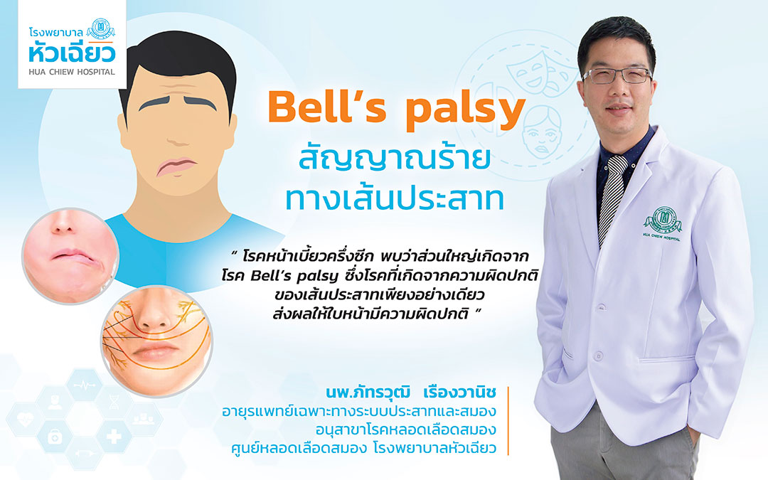 Bell’s palsy.. สัญญาณร้ายทางเส้นประสาท